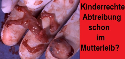 abtreibung8wo.jpg